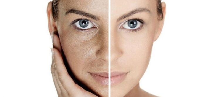 avant et après le rajeunissement de la peau du visage