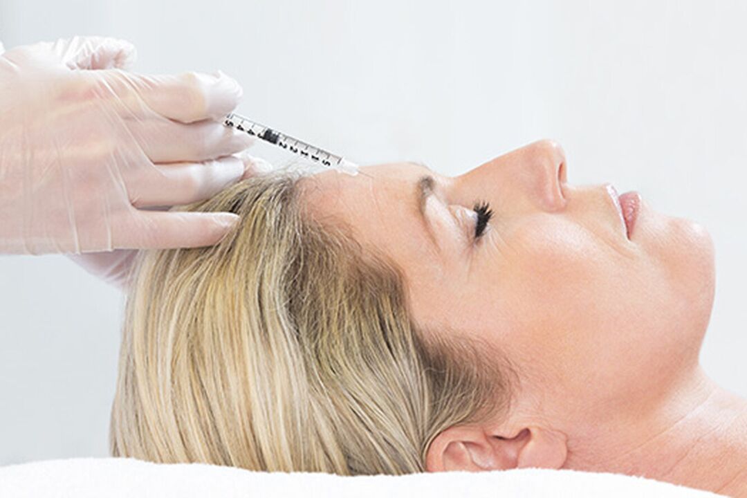 Le plasmolifting est une méthode d'injection de rajeunissement de la peau du visage